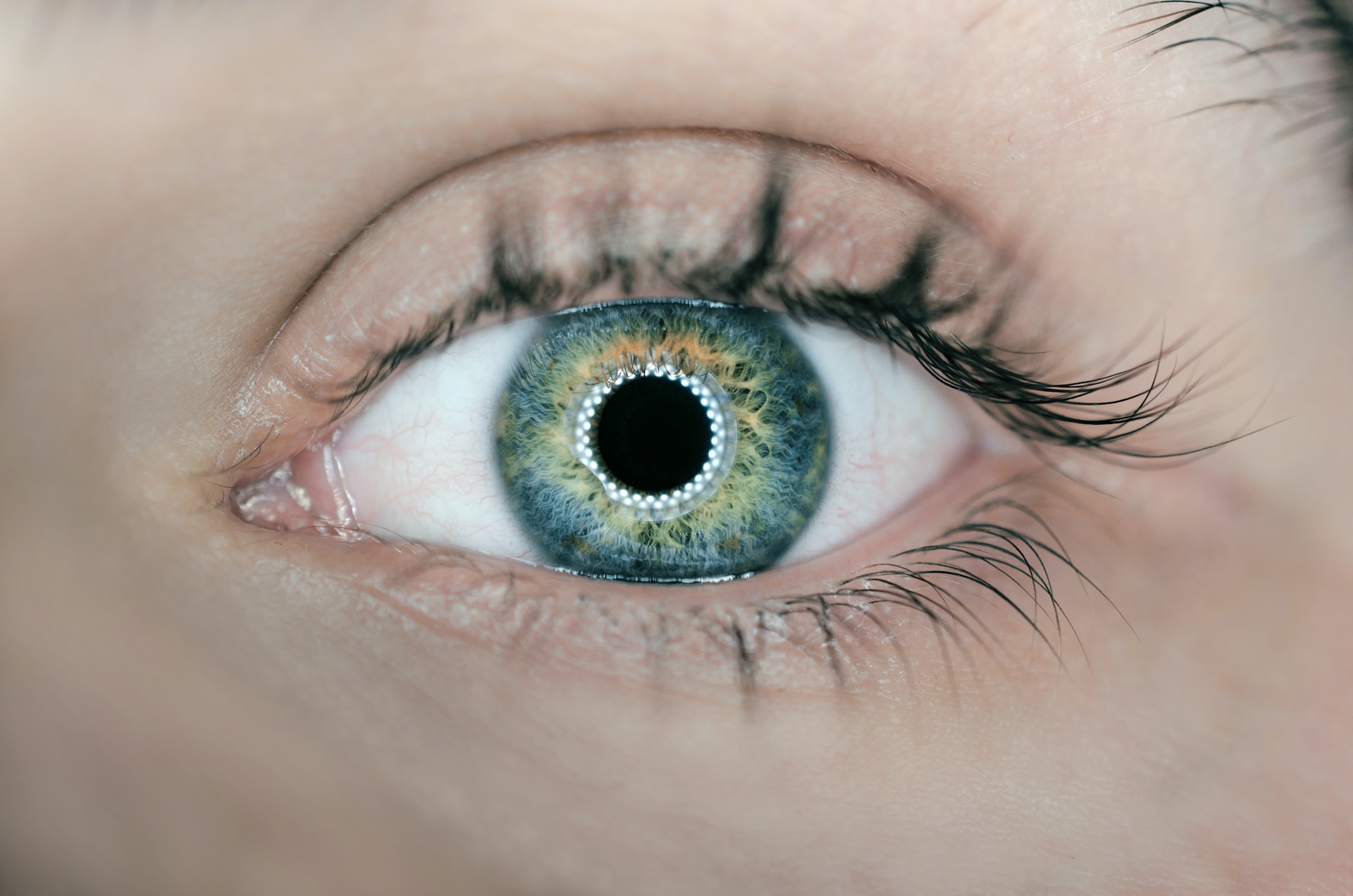 The Pros and Cons of Corrective Eye Surgery