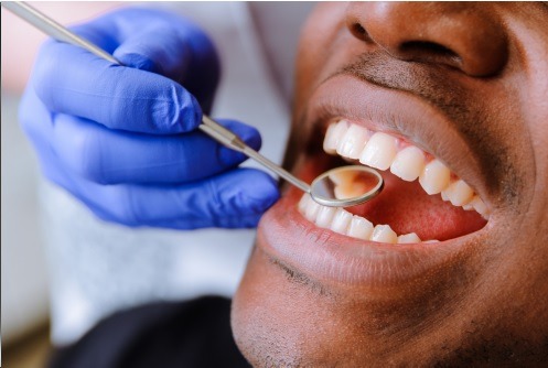 Keeping It Clean: How Often Should You Get Your Teeth Cleaned?