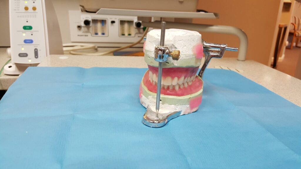 A set of dentures in a dental office image