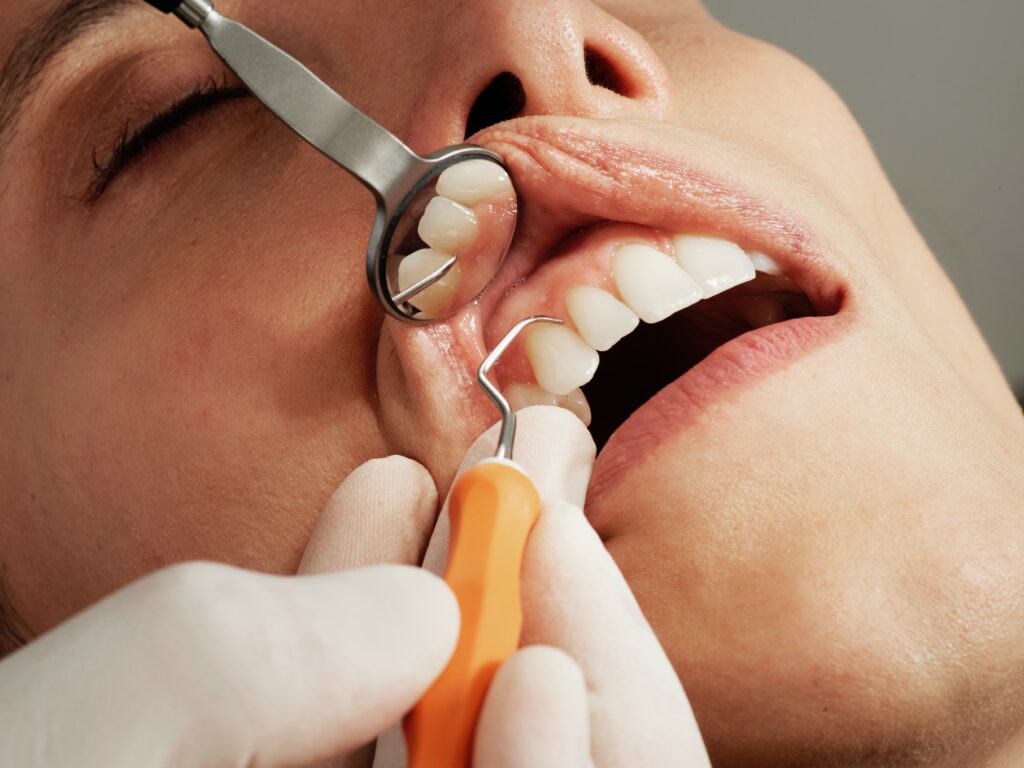 a woman having her dental check up image