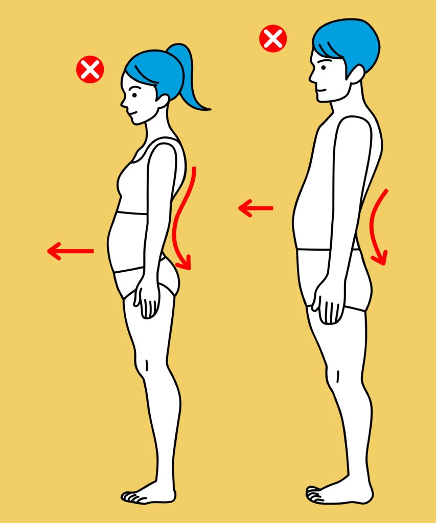 swayback-posture image