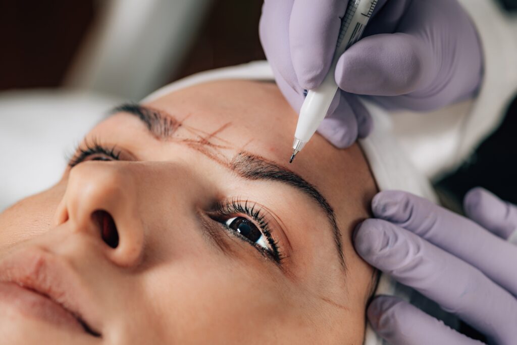 woman getting procedure with lines across eyebrow space