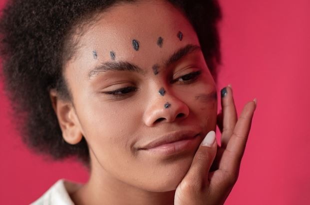 Acne Scars 101: How To Remove Them