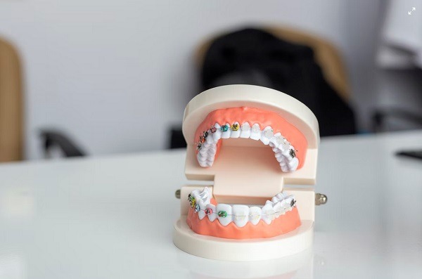 How can to adapt better with Invisalign braces The guidelines to keep in mind
