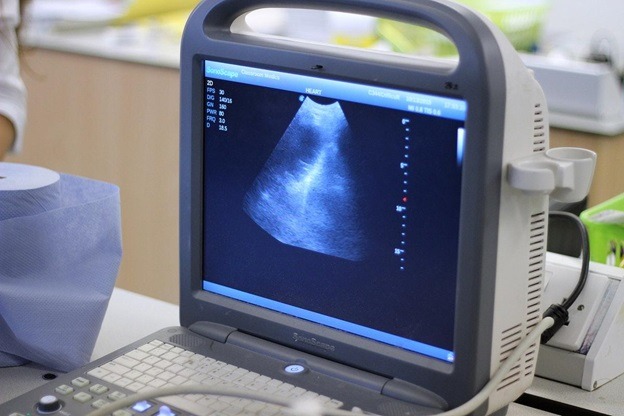 Ultrasound During Pregnancy - Prepare, Procedure, Types