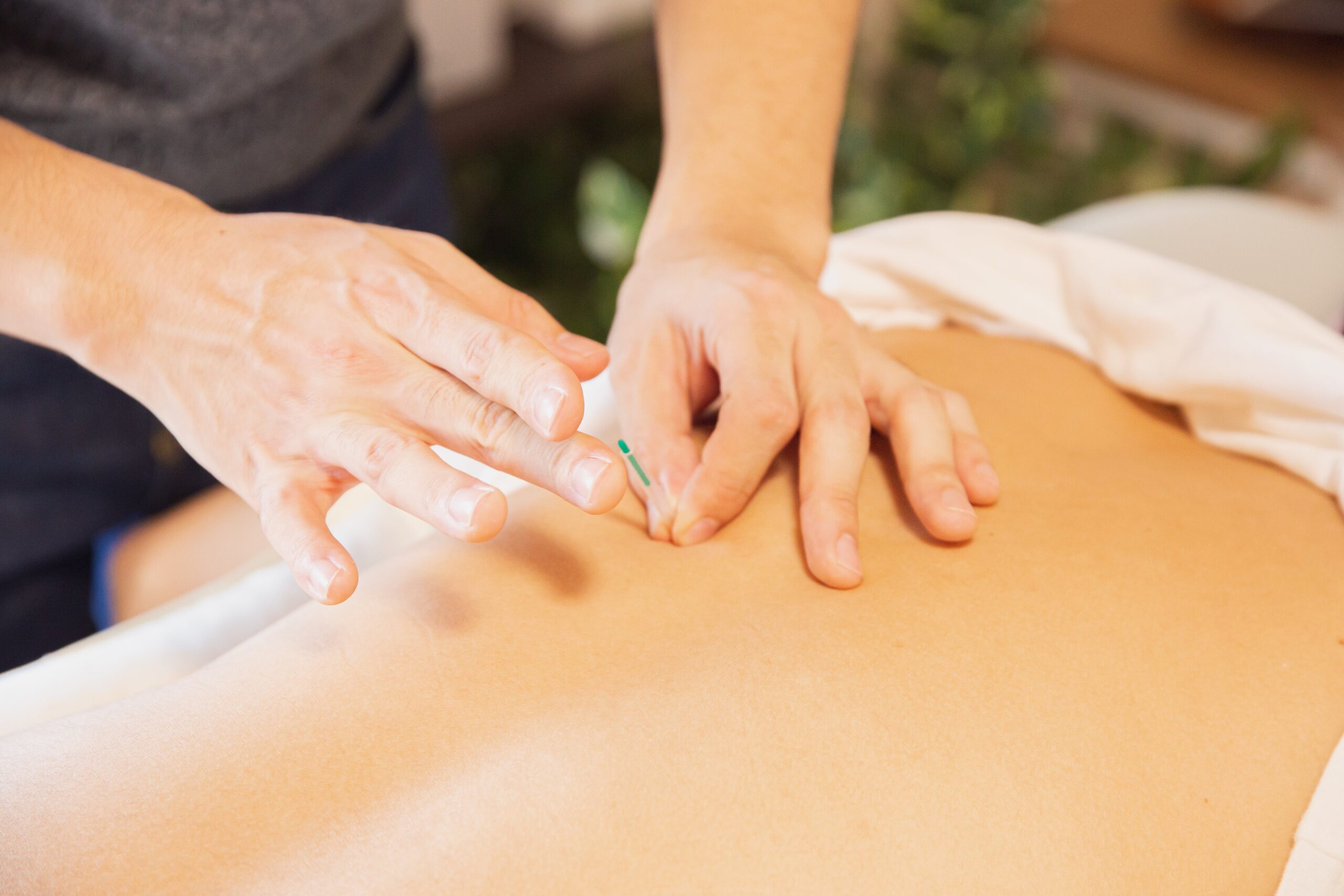 Exploring Acupuncture Services in Singapore Treatments, Conditions, and Long-Term Benefits